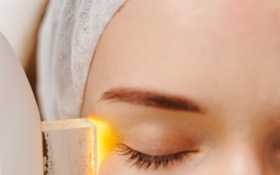 Unveiling the Magic of IPL: Say Goodbye to Pigmentation, Redness, and Acne!
