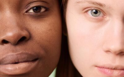 Brighten, Calm and Clear: Advanced IPL for Pigmentation, Redness and Acne