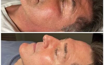 Firmer, smoother, stronger: how advanced skin tech lifts and refines your glow on the Fraser Coast